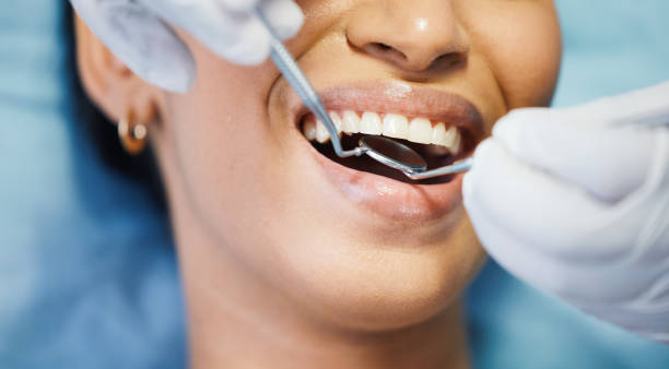 Best Emergency Gum Pain Relief  in Rmel Valley Village, CA